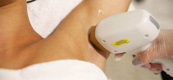 Laser Hair Removal Manchester
