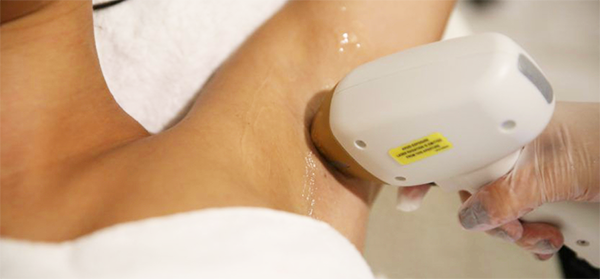 Laser Hair Removal Manchester Gina Collins