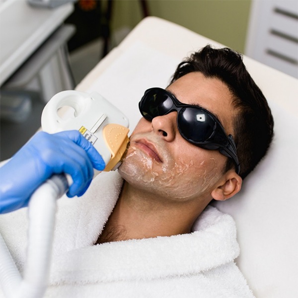 Laser Hair Removal